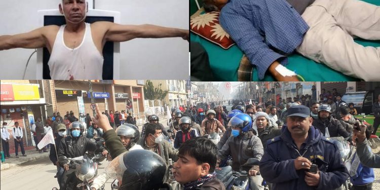 पुर्वमन्त्री यादव र झा सहित ४ जनालाई थप उपचारका लागि काठमाडौ लगियो