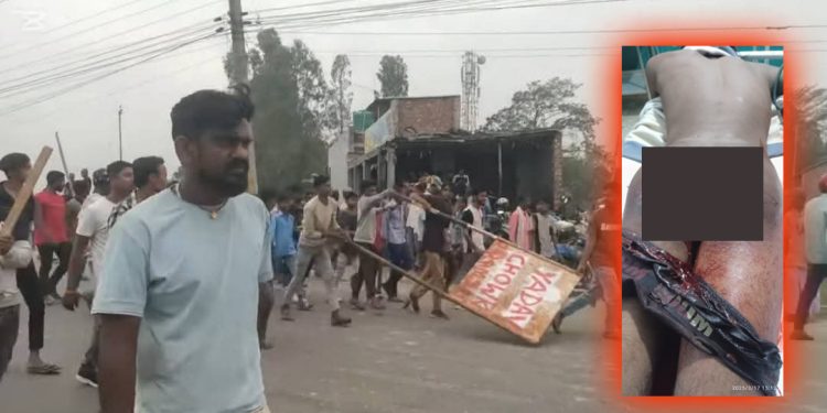 यादव चोक नाम राख्ने विवादमा एक युवकको मलद्वारमै गोली हानियो